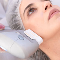 Bioestimulo de colágeno (Sculptra, Ultraformer e Radiesse)